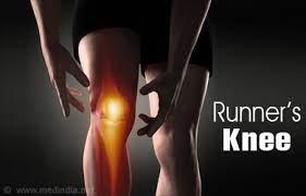 دليلك الشامل لـ"ركبة العداء": الأسباب، الأعراض، العلاج والوقاية