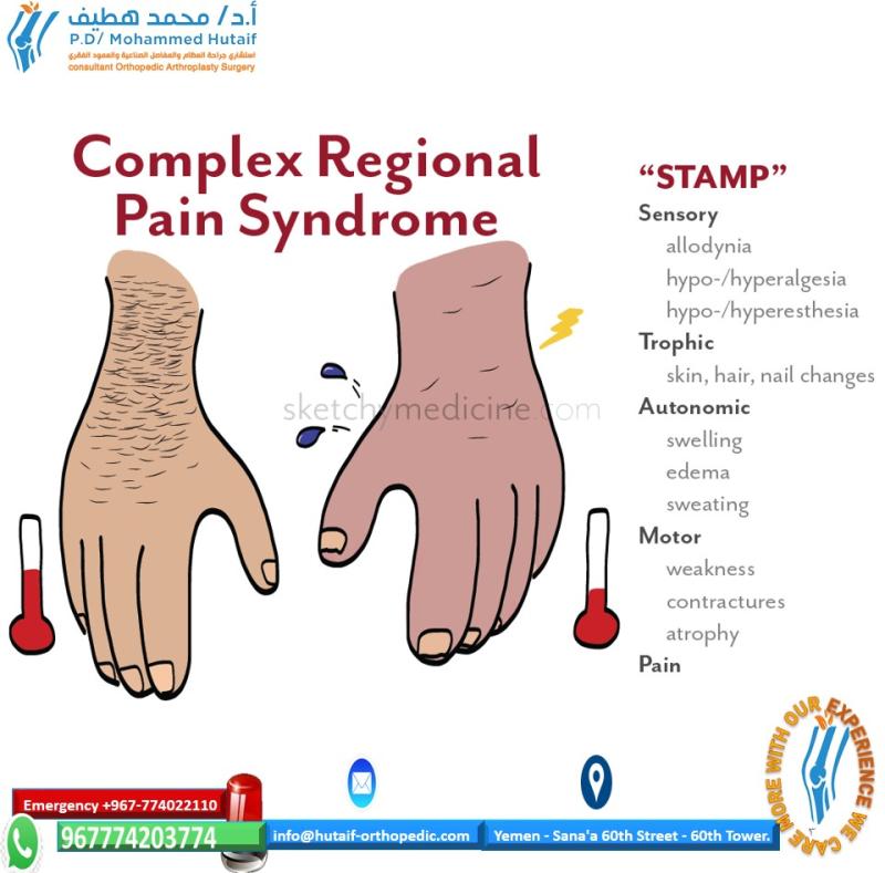 Late Phase of Complex Regional Pain Syndrome