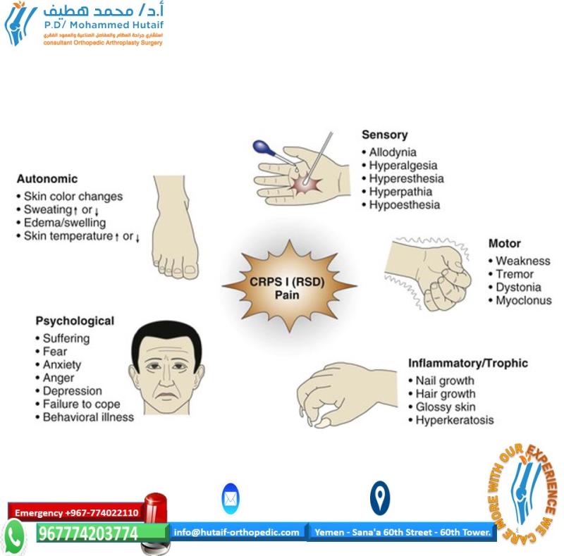 Complex Regional Pain Syndrome MAKING A DIAGNOSIS