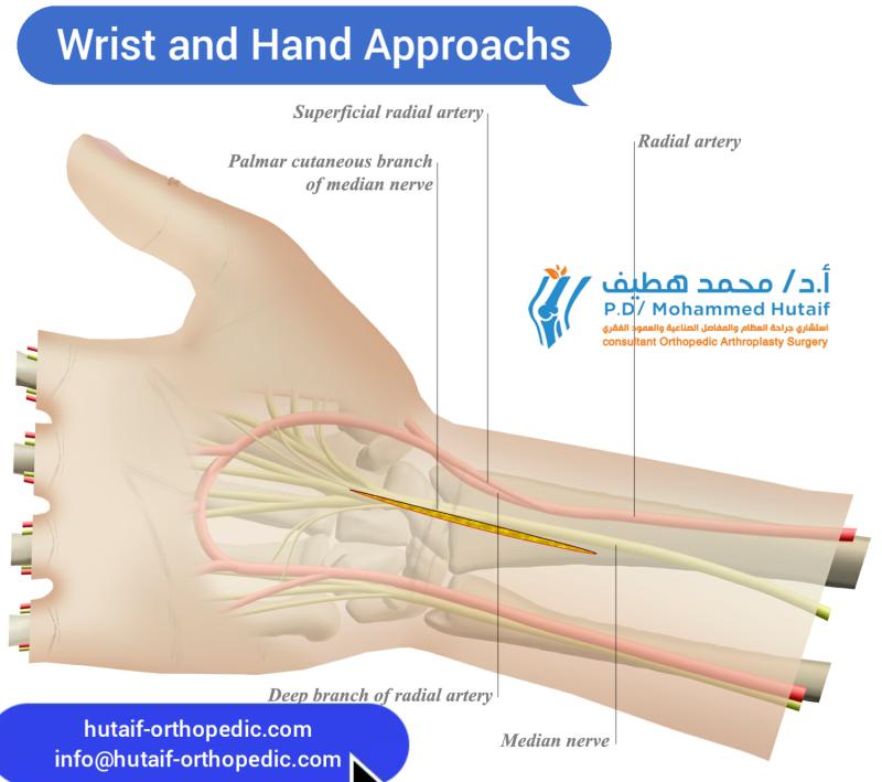 Wrist and Hand Approachs