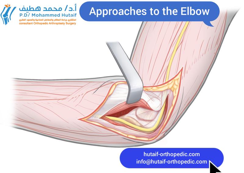Approaches to the Elbow