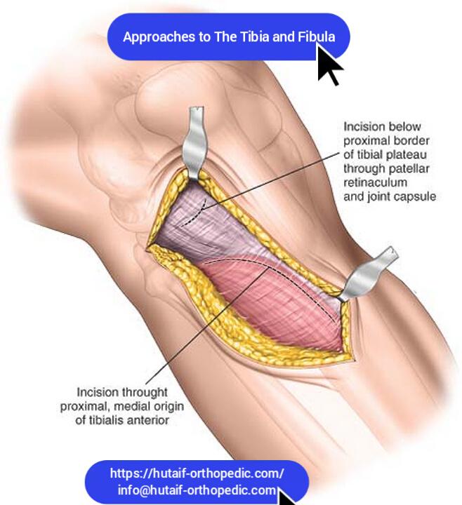 Approaches to The Tibia and Fibula