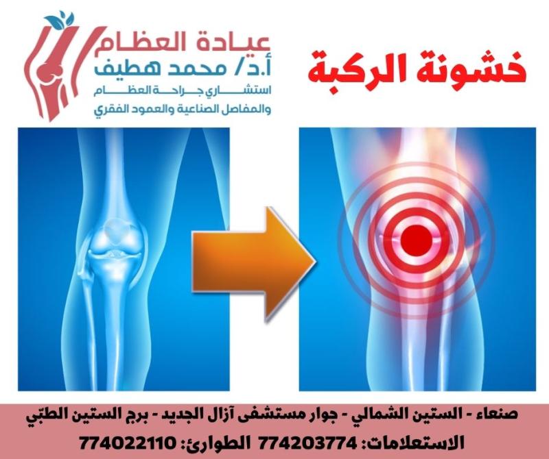 من هو أفضل دكتور عظام في اليمن؟ | تعرف على الأستاذ الدكتور محمد هطيف وخدماته وتخصصاته وإنجازاته