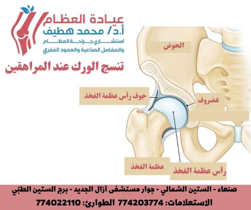 هل يعاني مراهقك من خلل التنسج الوركي؟ تعرف على الأعراض والعلاج