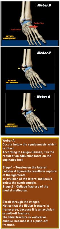 Illustration of danis danis dansis - Dr. Mohammed Hutaif