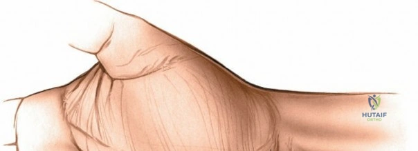 Clinical Image