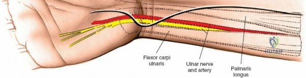 Clinical Image