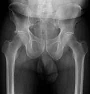 Orthopedic Board Review MCQs (2026 Edition) - Part 1